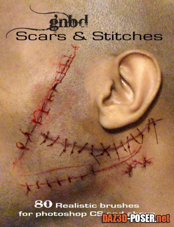 Dawnload GNBD Scars & Stitches for free